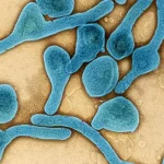 Virus Marburg